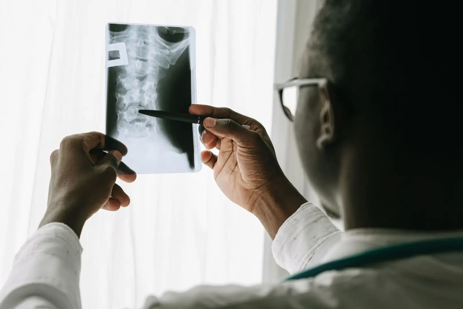 Clinician holding a spine x-ray up to window light and pointing to the vertebrae with a pen